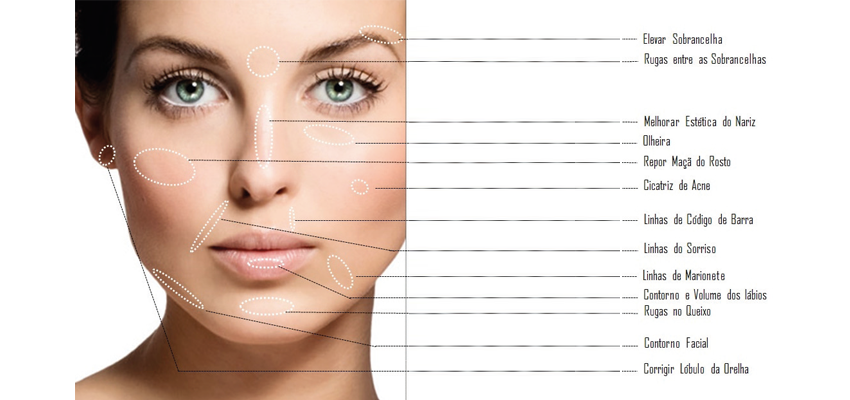 Preenchimento Facial Vit Cea